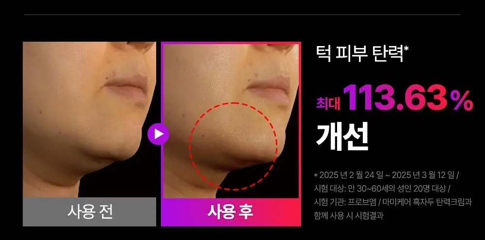 [7월 올영픽/이중턱개선] 마미케어 EMS 브이쎄라 (6 COLOR) 상세페이지 39